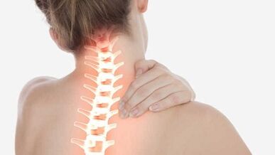 The main manifestations of cervical osteochondrosis