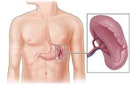 pathology of the spleen as a cause of pain under the left shoulder blade